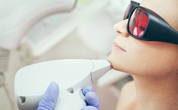 Laser hair removal at Delhi Laser Clinic